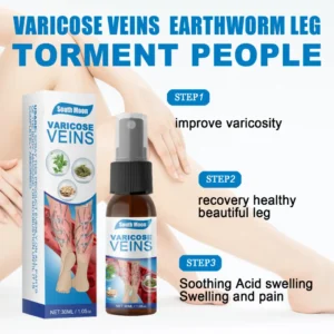 SOUTH MOON VARICOSE VEINS